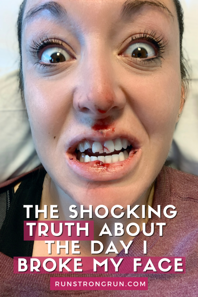 The Shocking Truth About the Day I Broke My Face